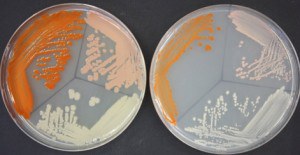 petri-dish-2-300x155.jpg#asset:135